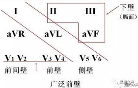 惊爆！AVL异常发病原因大，背后真相令人咋舌
